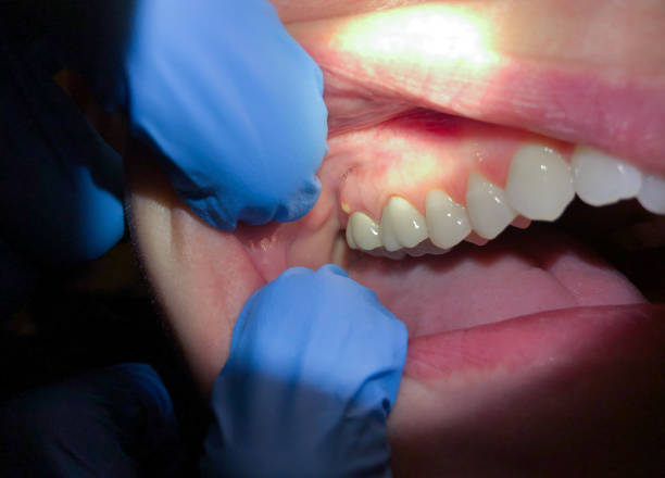 Best Walk-In Emergency Dentist in Belleville, MI